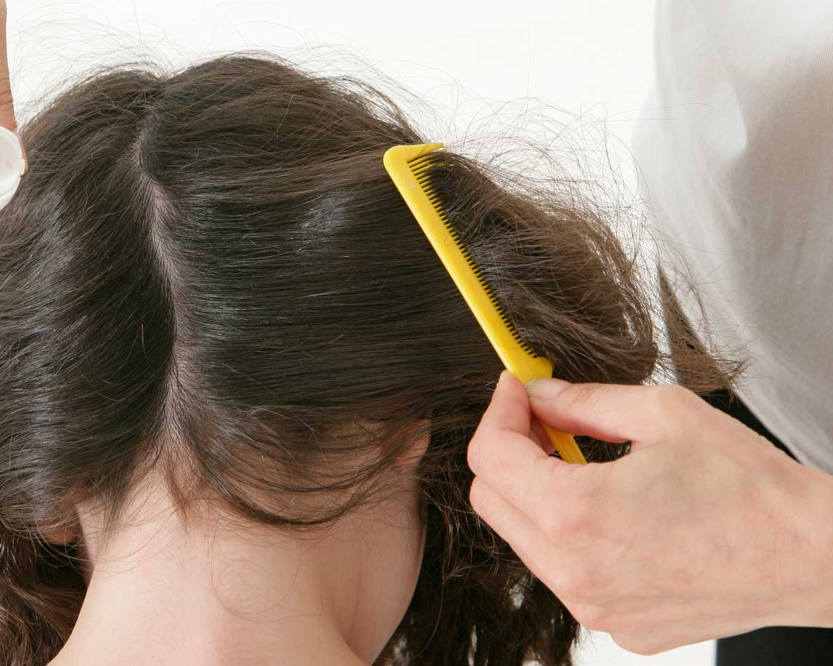 Tiña en la cabeza, ¿cómo se trata? – Dermatologia en Lima, Dermatologos en Lima Peru, laser antiacne en lima, tratamientos laser para las verrugas en lima, tratamientos laser para las cicatrices